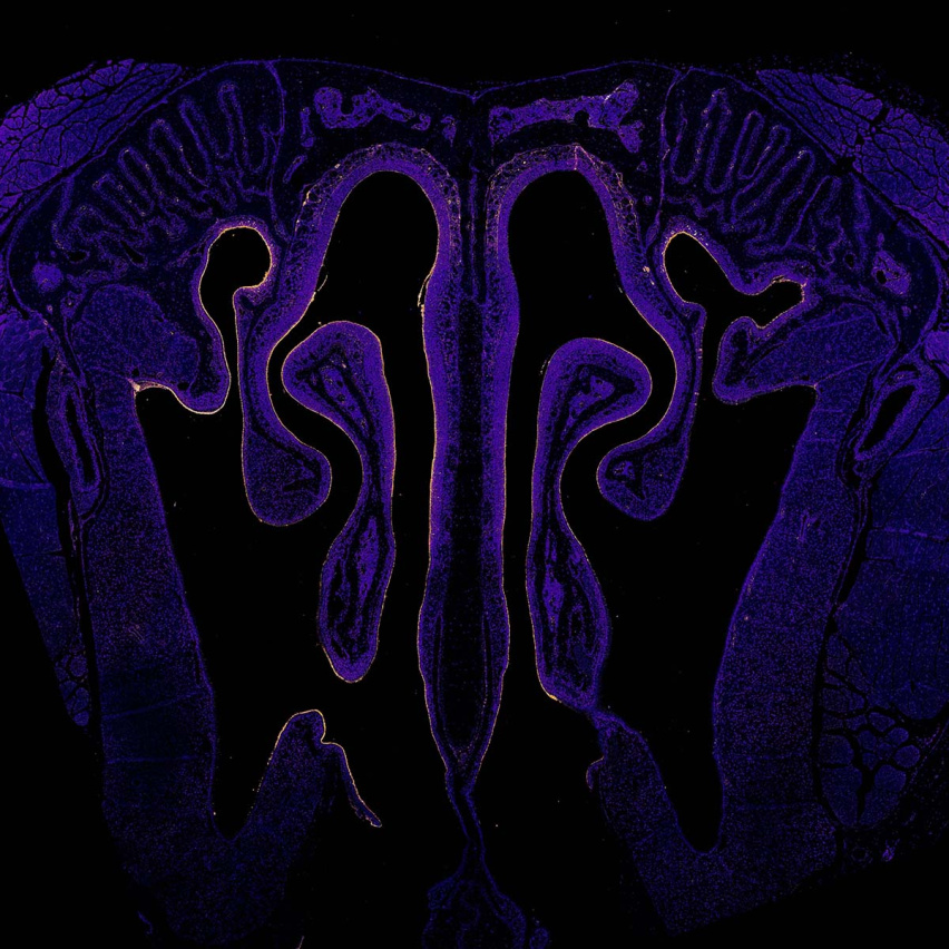 cells surrounding nasal cavities in indigo with glowing yellow around the edges