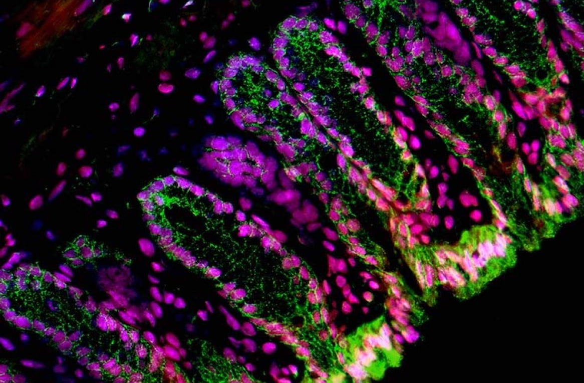 an accordion of endothelial cells stained in pink and green