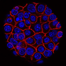 Pancreatic cancer cells (nuclei in blue) growing as a sphere encased in membranes (red)