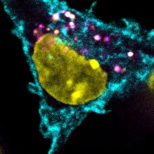 dendritic cell studded with cancer-associated proteins