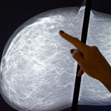 finger pointing at a mammogram