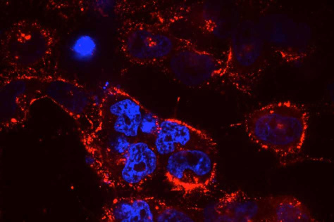 The lung-targeting nanoparticle 7C1 delivers therapeutic RNAs to cancer cells