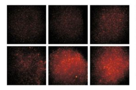 extravasating melanoma cells