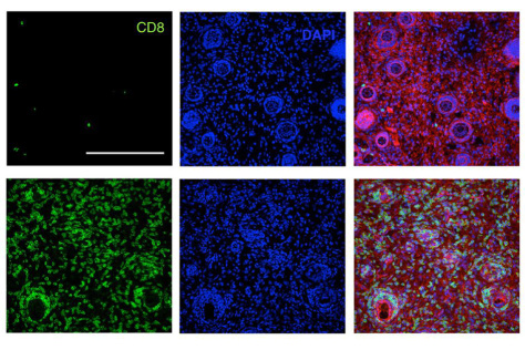 t cells before and after treatment with an immunotherapy