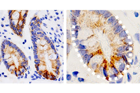 stem cells expressing high levels of a ketogenic enzyme, shown in brown.