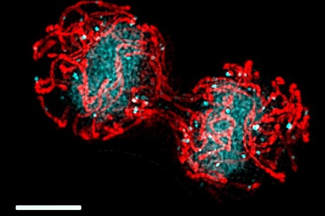 Cell dividing