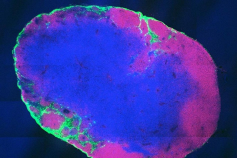 cross section of a lymph node shows that the molecular vaccine (green) has been taken up by immune cells in the lymph node