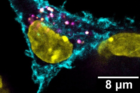 dendritic cell studded with cancer-associated proteins