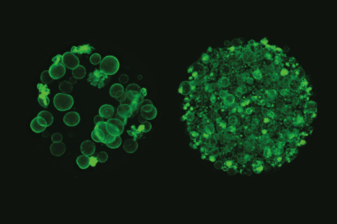 two sets of spherical organoids in green fluorescence, one more densely populated 