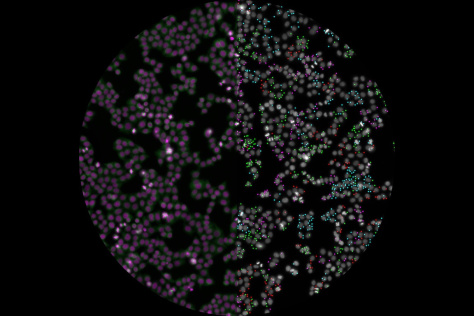 sphere of pink, white and green dots, the left side blurry, the right side in focus