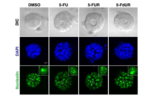 Three rows show a tumor responding to types of treatment. Columns are labeled “DMSO, 5-FU, 5-FUR, 5-FdUR.” Top shows grey microscopic image of tumor. Middle row is stained blue and shows blue lumps. Bottom row is stained green and shows smaller bits.